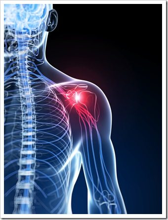 Shoulder Pain West Houston TX Rotator Cuff Syndrome