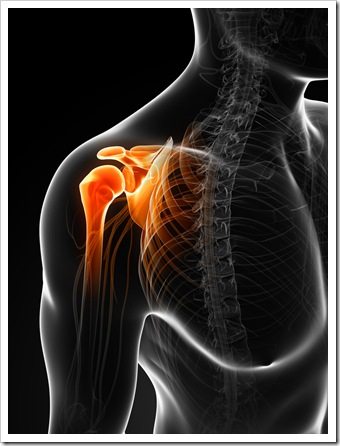 Shoulder Pain Houston TX Bursitis